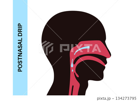 Postnasal drip poster 134273795