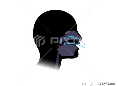 Obstructive sleep apnea 134273800