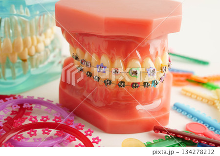 Orthodontic ligatures rings and ties, elastic rubber bands on orthodontic braces, model for dentist studying about dentistry. 134278212