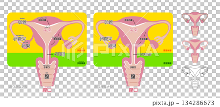 女性生殖系統示意圖及其各部份名稱：子宮、輸卵管、卵巢、陰道、子宮頸 134286673