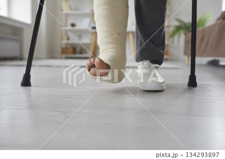 Unhealthy young woman with broken leg or foot injury is undergoing rehabilitation at home. Girl is standing in the living room on crutches with bandaged leg 134293897