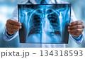 Doctor with radiological chest xray film for medical diagnosis. 134318593