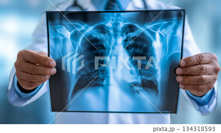 Doctor with radiological chest xray film for medical diagnosis. 134318593