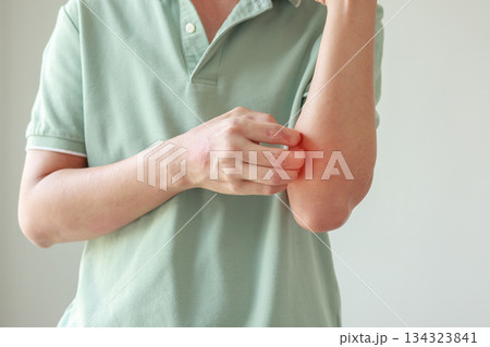 Young asian man itching and scratching on arm from allergic itchy dry skin eczema dermatitis insect bites Young asian man itching and scratching on arm from allergic itchy dry skin eczema dermatitis insect bites 134323841
