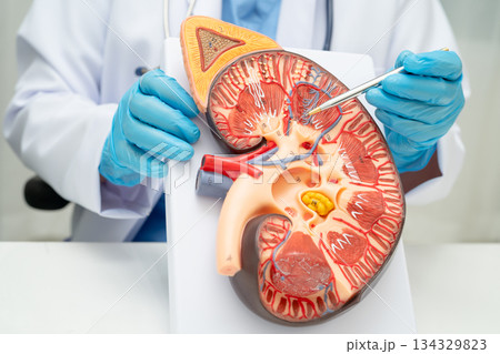 Chronic kidney disease, doctor with model for treatment urinary system, urology, Estimated glomerular filtration rate eGFR. Chronic kidney disease, doctor with model for treatment urinary system, urology, Estimated glomerular filtration rate eGFR. 134329823