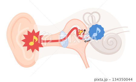 アブミ骨筋反射のイラスト素材 134350044
