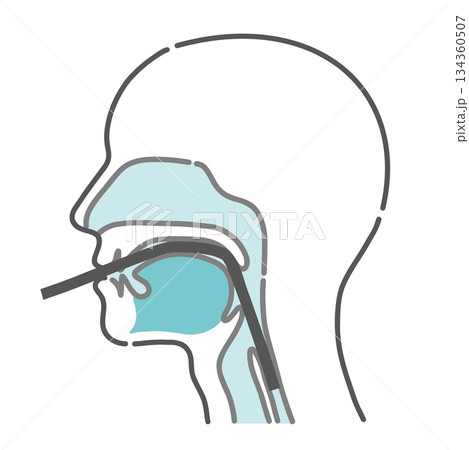 経口内視鏡の挿入ルート図（口からの胃カメラ・断面図） 134360507
