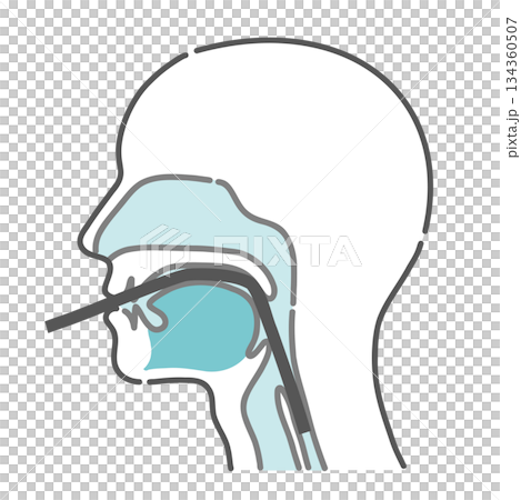 経口内視鏡の挿入ルート図（口からの胃カメラ・断面図） 134360507