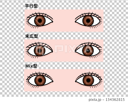 雙眼皮的類型 雙眼皮的類型 134362815