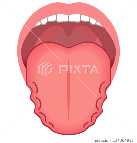 ふちがデコボコしている舌　舌でわかる健康状態　舌診　舌の健康 134364913