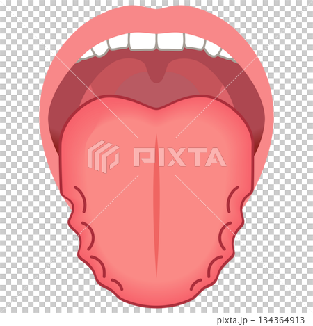 ふちがデコボコしている舌　舌でわかる健康状態　舌診　舌の健康 134364913