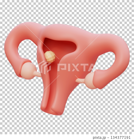 uterus and implantation cartoon style 3D graphic 134377191