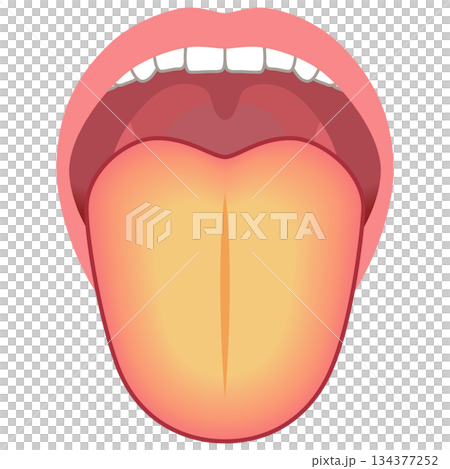 Yellow tongue - Health status as determined by the tongue - Tongue diagnosis - Tongue health Yellow tongue - Health status as determined by the tongue - Tongue diagnosis - Tongue health 134377252