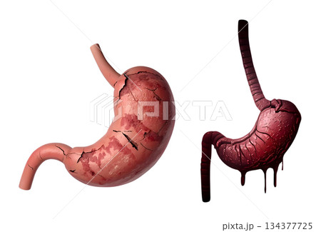 病気の胃のイメージイラスト 134377725