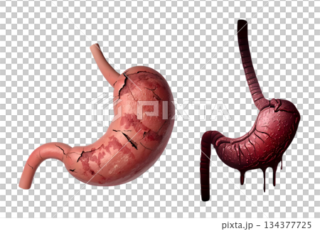 病気の胃のイメージイラスト 134377725