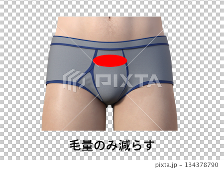 男性の美容脱毛 Vラインの処理方法と種類 毛量のみ減らす 134378790