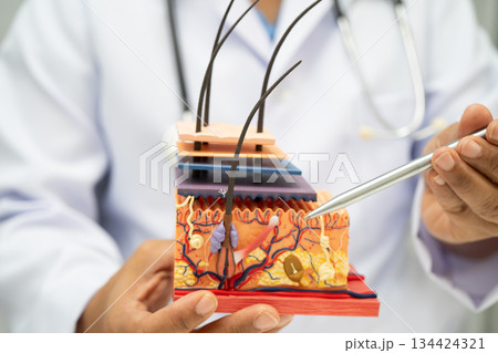 Asian dermatologist doctor holding skin structure model anatomy for treatment in hospital, hair transplant. 134424321