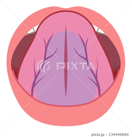 舌裏の静脈　瘀血　舌でわかる健康状態　舌診　舌の健康 134440664