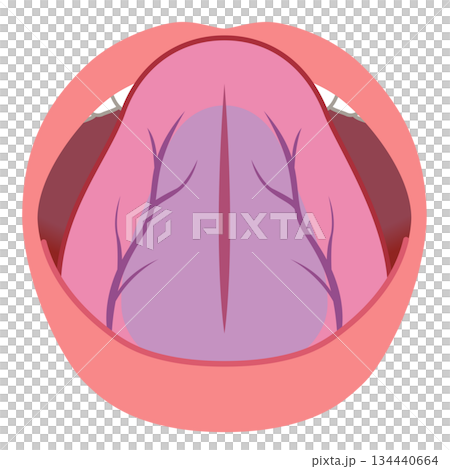 舌裏の静脈　瘀血　舌でわかる健康状態　舌診　舌の健康 134440664