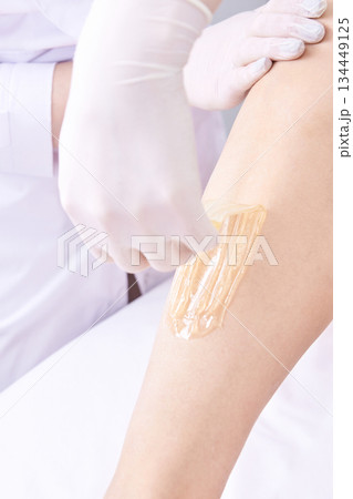 Caucasian adult female leg sugaring hair removal treatment by gloved hands 134449125