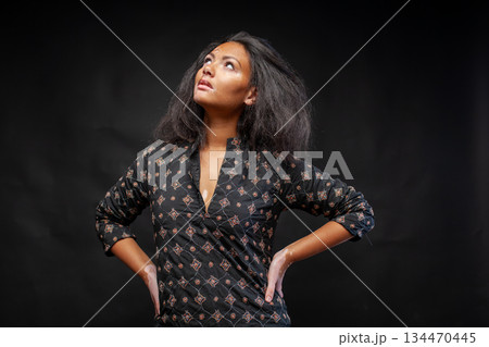 Young African woman with vitiligo wearing 134470445