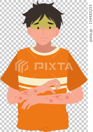 a man with eczema dermatitis and red rash on arms showing allergy symptoms a man with eczema dermatitis and red rash on arms showing allergy symptoms 134483255