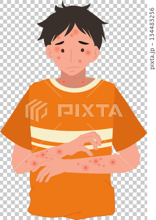skin allergy and dermatitis symptoms shown on man medical illustration skin allergy and dermatitis symptoms shown on man medical illustration 134483256
