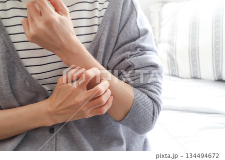 腕を掻く女性 アトピー 湿疹 腕を掻く女性 アトピー 湿疹 134494672