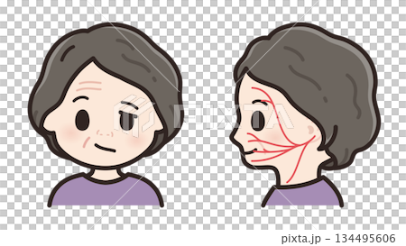 左顔面神経麻痺の顔と顔面神経の運動神経の走行のイラスト 左顔面神経麻痺の顔と顔面神経の運動神経の走行のイラスト 134495606