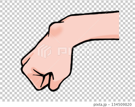 Illustration of a hand with a ganglion 134509820
