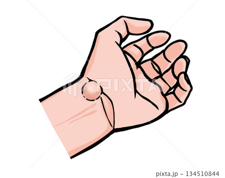 ガングリオンができた手のイラスト 134510844