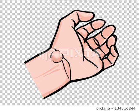 一隻手長有腱鞘囊腫的插圖 134510844