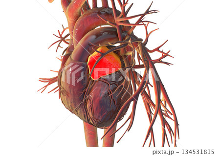 Left heart auricle highlighted in red, 3D illustration Left heart auricle highlighted in red, 3D illustration 134531815