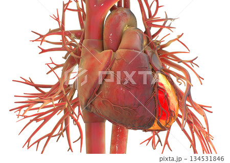 Human heart with left ventricle highlighted in red, 3D illustration. 134531846