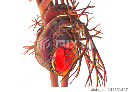 Human heart with left ventricle highlighted in red, 3D illustration. 134531847