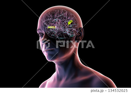 Human brain with the transverse temporal gyri, 3D illustration 134532025