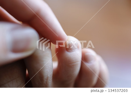 足の爪に黒い汚れが付着した指先のクローズアップ。 134537203