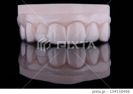 3D printed transparent dental template for gum correction fixed on model on black background. 134538498