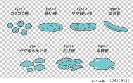 布里斯托量表（糞便特徵和形狀分類）圖示 134539122