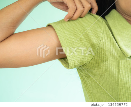Woman Hyperhidrosis Wet Green shirt Underarm Hand Close Up. Problem Armpit Sweat Stains and Strong Body Odor,Hyperhidrosis Sweating,Hygiene for Good Health Concept,Sweaty Under Arm. Woman Hyperhidrosis Wet Green shirt Underarm Hand Close Up. Problem Armpit Sweat Stains and Strong Body Odor,Hyperhidrosis Sweating,Hygiene for Good Health Concept,Sweaty Under Arm. 134539772