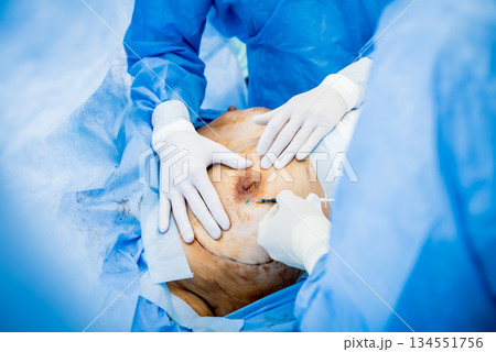 Surgery to remove the breast and replace it with an implant. Surgery to remove the breast and replace it with an implant. 134551756