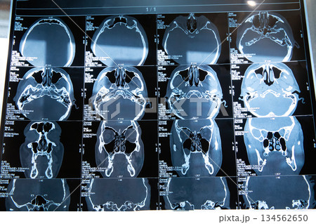 Comprehensive CT Scan Views of Human Skull Anatomy Comprehensive CT Scan Views of Human Skull Anatomy 134562650