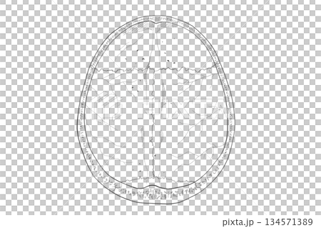 Cranial vault Cranial vault 134571389