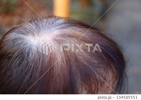 シニア女性の頭皮とつむじ｜白髪と薄毛に悩むリアルな髪の状態 134585551