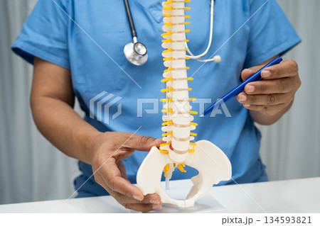 Asian doctor holding spinal nerve and bone model, Lumbar spine displaced herniated disc fragment for treatment medical in the orthopedic department. 134593821