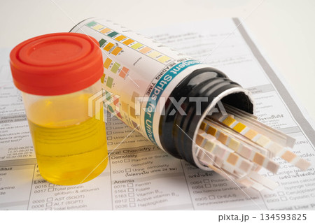 Urinalysis, urine cup with reagent strip pH paper test and comparison chart in laboratory. 134593825