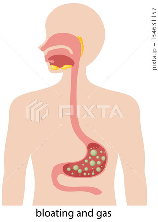 Digestive System Illustration with Bloating and Gas 134631157