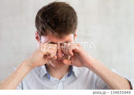 Portrait of young guy with itchy eyes in studio 134635949