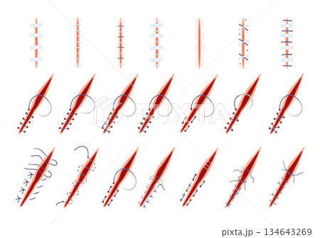 Suture icons set cartoon vector. Wound surgical Suture icons set cartoon vector. Wound surgical 134643269