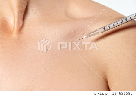 Needle insertion into shoulder area during medical procedure in a clinical setting Needle insertion into shoulder area during medical procedure in a clinical setting 134656586